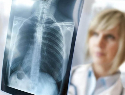 Aprende sobre Mycoplasma pneumoniae